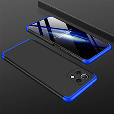 Custodia Plastica Rigida Cover Opaca Fronte e Retro 360 Gradi P01 per Xiaomi Mi 11 5G Blu e Nero