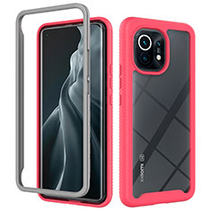 Custodia Silicone Trasparente Laterale 360 Gradi Cover per Xiaomi Mi 11 5G Rosa Caldo