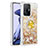 Custodia Silicone Cover Morbida Bling-Bling con Anello Supporto S01 per Xiaomi Mi 11T 5G