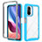 Custodia Silicone Trasparente Laterale 360 Gradi Cover ZJ4 per Xiaomi Mi 11i 5G Cielo Blu