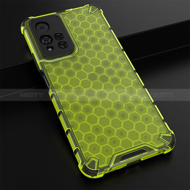 Custodia Silicone Trasparente Laterale 360 Gradi Cover AM2 per Xiaomi Mi 11i 5G (2022)